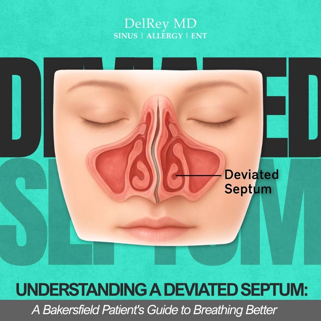 deviated septum del rey md